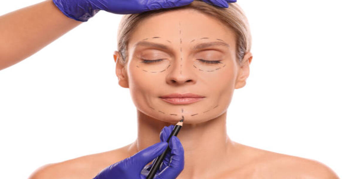 Genioplasty Surgery: Transform Your Chin with Expert Care