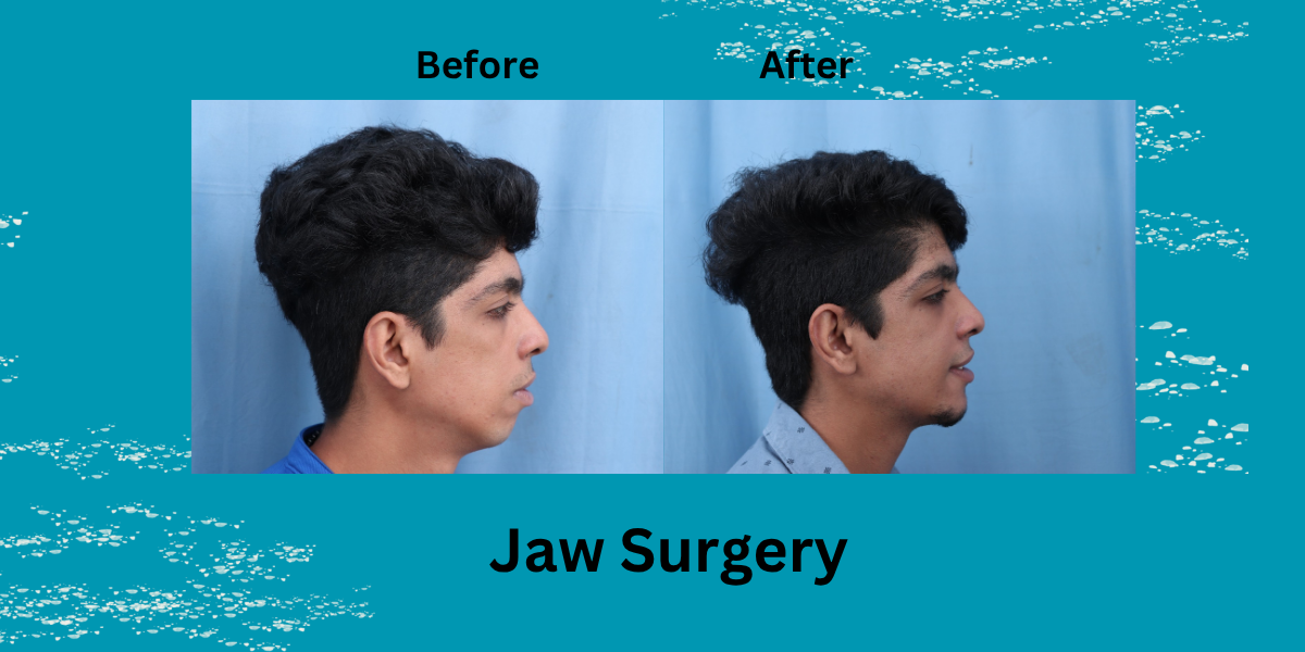 Do I Really Need Jaw Surgery? 7 Signs You Shouldn’t Ignore
