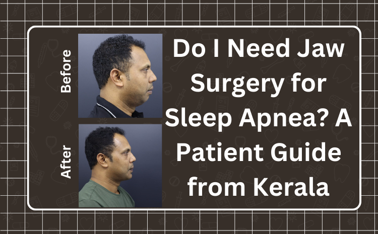 Do I Need Jaw Surgery for Sleep Apnea? | Kerala Specialist Guide
