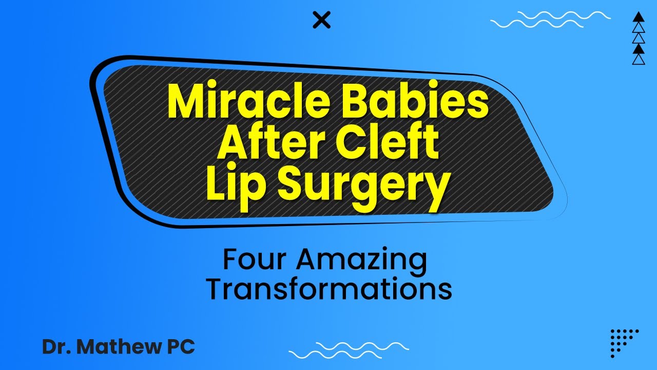 Is Cleft Lip Surgery Cost In India Affordable? | Cleft Lip Surgery 2025