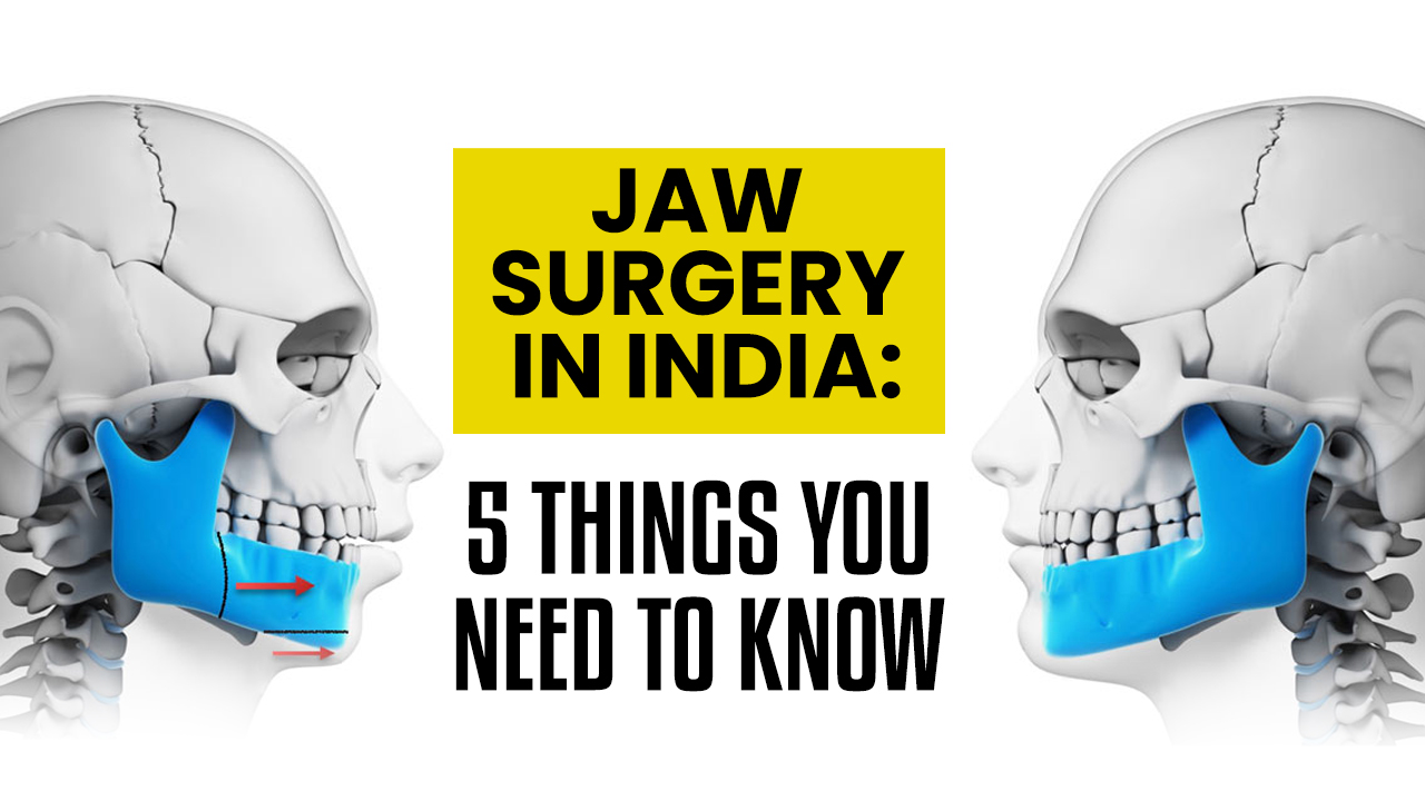 Jaw Surgery In India: 5 Things You Need To Know