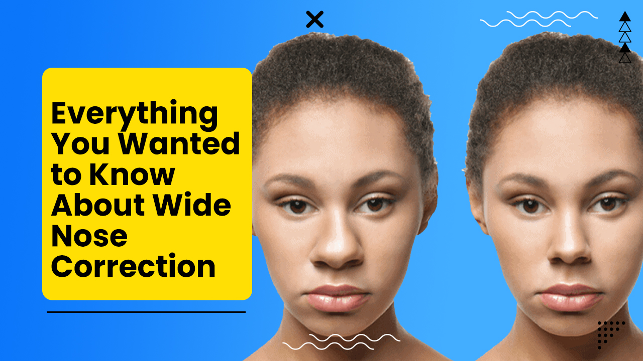 Best Wide Nose Correction Surgery: Procedure, Types, Cost