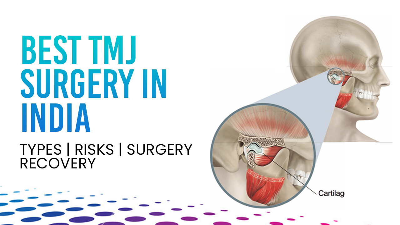 Best TMJ Surgery In India- Types – Risks – Surgery – Recovery