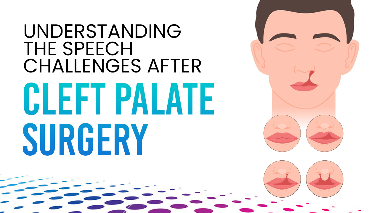 Understanding The Challenges Of Speech After Cleft Palate Surgery