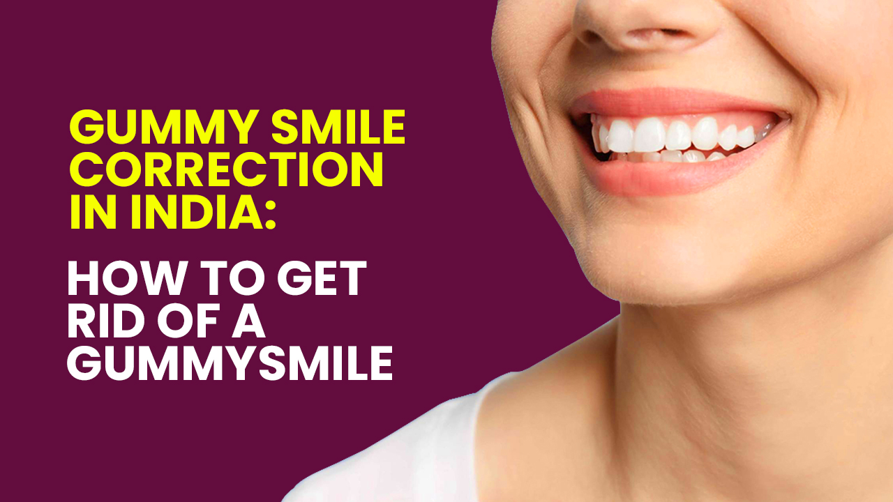 Best Gummy Smile Correction In India