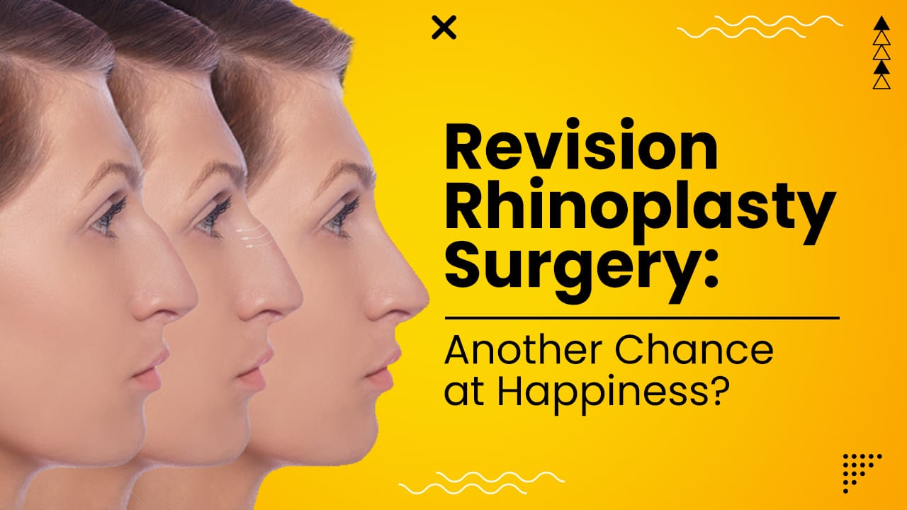 Best Revision Rhinoplasty Surgery In India