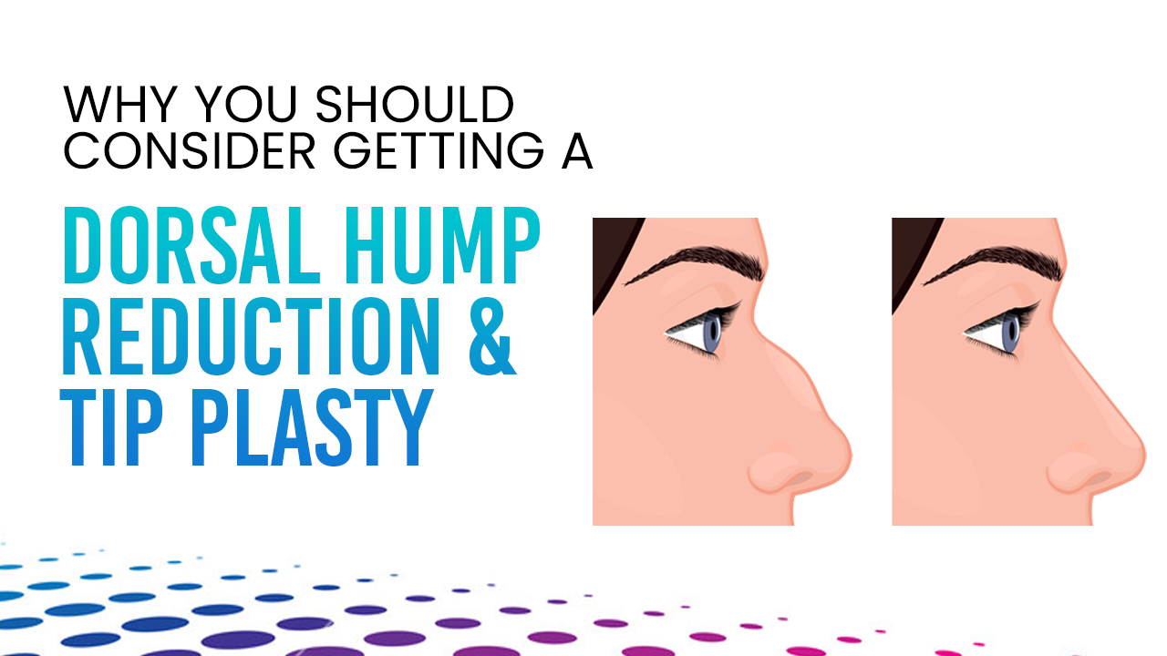 Best Dorsal Hump Reduction In India And Tip Plasty