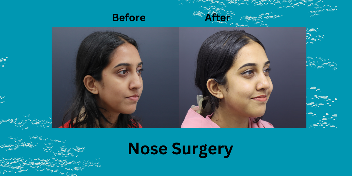 face surgery in India